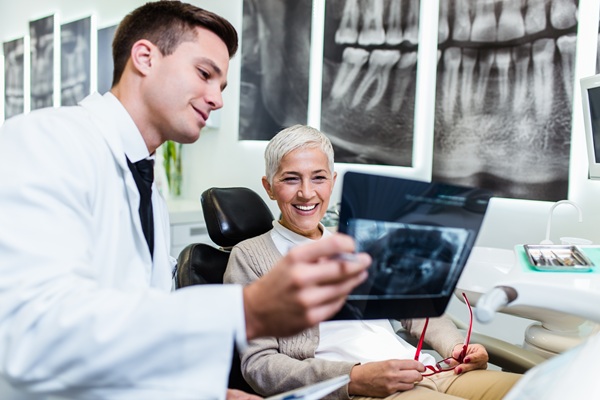 Teeth Replacement    : Dental Implants